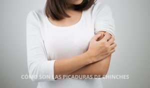 picaduras de chinches
