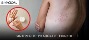 sintomas-de-picadura-de-chinche